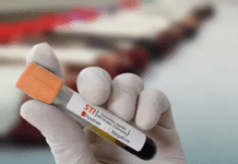 Jharkhand: 7-Year-Old Tests HIV Positive, Family Blames Blood Bank for Infected Blood; Probe On 7-year-old tests HIV positive in Jharkhand