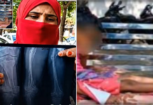 Bribe Demand Turns Violent: Muzaffarnagar Doctors Accused Of Intentionally Breaking Mentally Ill Girl’s Leg Bribe Demand Turns Violent: Muzaffarnagar Doctors Accused Of Intentionally Breaking Mentally Ill Girl’s Leg