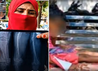Bribe Demand Turns Violent: Muzaffarnagar Doctors Accused Of Intentionally Breaking Mentally Ill Girl’s Leg Bribe Demand Turns Violent: Muzaffarnagar Doctors Accused Of Intentionally Breaking Mentally Ill Girl’s Leg