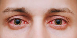 Eye Flu Infections Increase During Monsoon: 5 Symptoms That Need Attention Eye Flu Infections Increase During Monsoon: 5 Symptoms That Need Attention