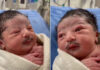 Baby born with a mustache! Picture goes viral on the internet Baby born with Mustache