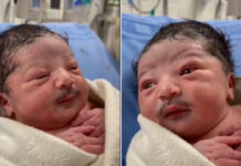 Baby born with a mustache! Picture goes viral on the internet Baby born with Mustache