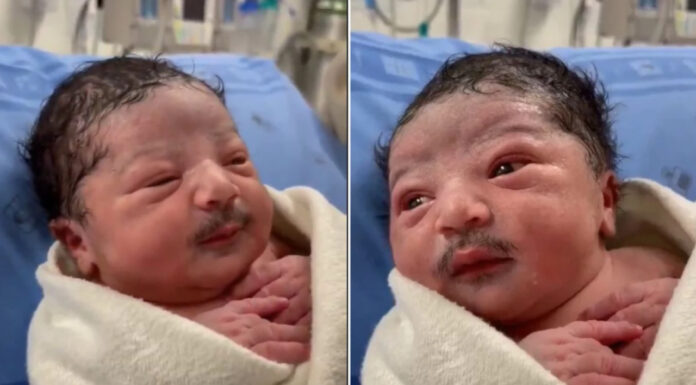 Baby born with a mustache! Picture goes viral on the internet Baby born with Mustache